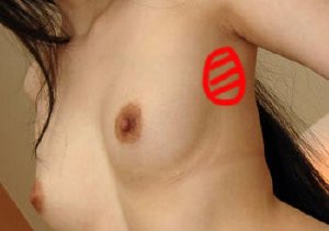 スペンスの乳腺尾部の場所